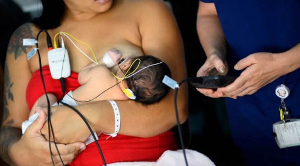 Hospital Regional do Gama passa a oferecer exame auditivo mais detalhado para recém-nascidos